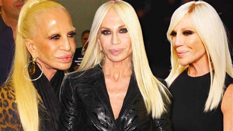 donatelly versace|donatella versace face what happened.